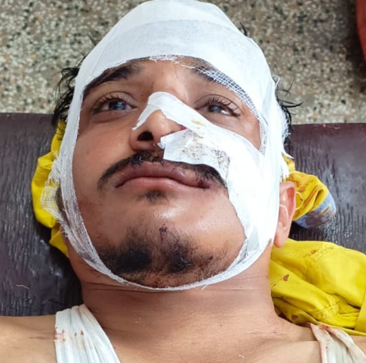 अज्ञात वाहन की टक्कर से बाइक सवार युवक गंभीर रूप से घायल, जिला अस्पताल रेफर