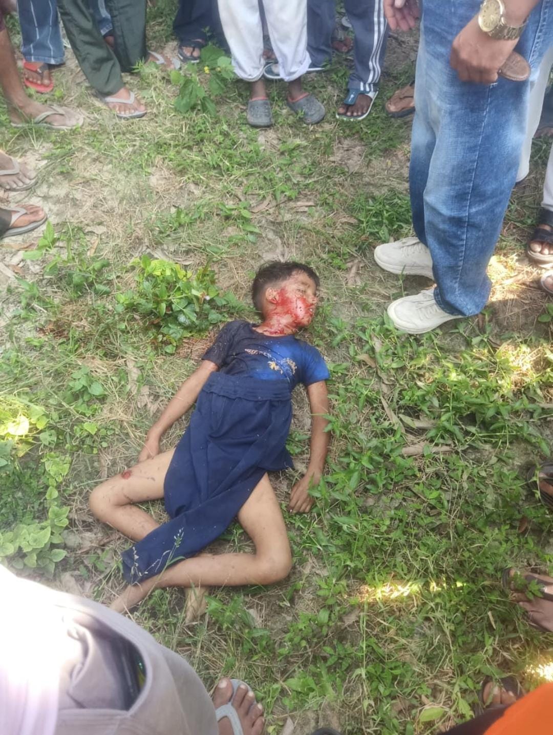 बेहट सहारनपुर गोगामेड़ी मेले में दर्दनाक हादसारू कुत्तों के झुंड ने बच्चे को नोच-नोचकर मार डाला