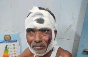 दो पक्षों के आपसी विवाद में जमकर चले लाठी-डंडे, युवती समेत पांच लोग गंभीर