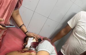 आवारा पशु स्कूटी से भिड़ा युवक घायल