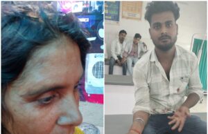 दबंगों ने महिला को बेरहमी से पीटा, जान से मारने की दी धमकी, पुलिस बनी मुकदर्शक