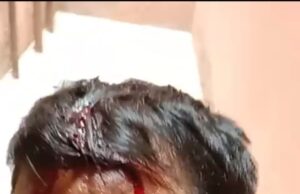 जमीन कब्जाने के लेकर दबंगों ने युवक पर किया जानलेवा हमला