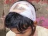 आम बेचकर लौट रहे व्यापारी के सिर पर चाकू से हमला, मारपीट कर, 55 हजार लूटे