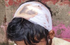 आम बेचकर लौट रहे व्यापारी के सिर पर चाकू से हमला, मारपीट कर, 55 हजार लूटे