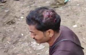 कोटेदार ने राशन कार्ड से खाद्यान्न लेने गये युवक के मारपीट कर किया घायल