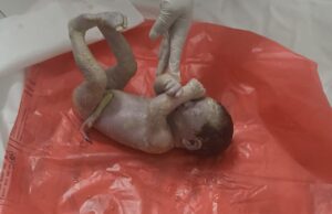 इमरजेंसी वार्ड में नवजात शिशु का शव कूड़ा दान में मिलने से मचा हड़कंप