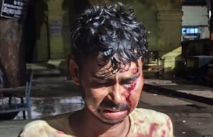 दबंग ने कैंची से गोद दिया एक युवक का चेहरा