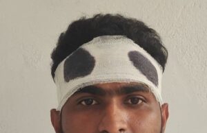 पुरानी रंजिश में युवक पर जानलेवा हमला, गंभीर रूप से घायल खेतासराय पुलिस ने दर्ज किया मुकदमा