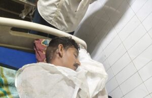 सोते युवक पर पेट्रोल डालकर लगाई आग, 50% तक झुलसा अज्ञात हमलावर फरार, जिला अस्पताल में भर्ती