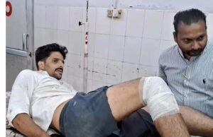 बाइक देने से इंकार पर चली गोलियां युवक गंभीर घायल