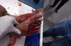 सड़क हादसे में दो युवक घायल, सैफई रेफर