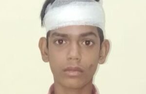 खेलते समय 10 वर्षीय बच्चे पर हमला, सिर फटा; परिजनों ने की कार्रवाई की मांग