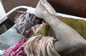 नाले में लहूलुहान मिला युवक, मचा हडकंपसूचना पर पहुंची पुलिस ने युवक को भेजवाया अस्पताल