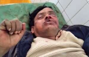 अज्ञात वाहन की टक्कर से बाइक सवार घायल