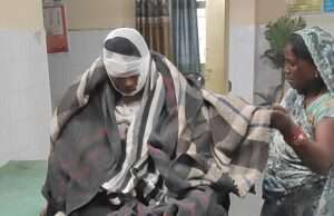 बिजली की चिंगारी उठने से जल गई युवती, जिला अस्पताल रेफर