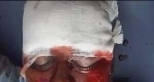 हरदोई राजा मार्ग पर फिर हुआ भीषण हादसा, NST स्कूल के पास दर्दनाक एक्सीडेंट