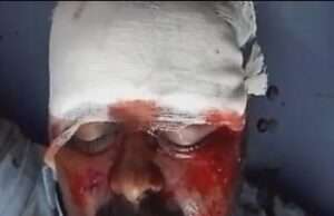 हरदोई राजा मार्ग पर फिर हुआ भीषण हादसा, NST स्कूल के पास दर्दनाक एक्सीडेंट