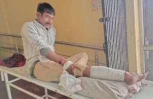 घर के बाहर खड़े युवक को तेज रफ्तार बाइक ने मारी टक्कर, हालत गंभीर