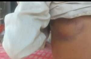 नमकीन लेने आए युवकों ने पैसे मांगने पर गरीब दुकानदार की पिटाई