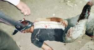 पौसला चौराहे पर युवक व मां पर जानलेवा हमला, दबंगों ने लाठी-डंडों व पत्थरों से किया घायल