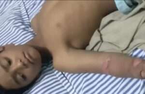 प्रतापगढ़ में हाईटेंशन तार से हादसा: 8 वर्षीय बालक गंभीर, हाथ काटना पड़ा