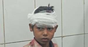 30 फीट गहरे सूखे कुएं में गिरा 13 वर्षीय किशोर, 1 घंटे बाद रेस्क्यू