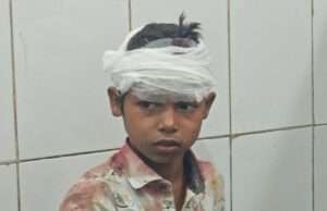 30 फीट गहरे सूखे कुएं में गिरा 13 वर्षीय किशोर, 1 घंटे बाद रेस्क्यू