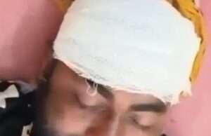 पशु चराने को लेकर विवाद में युवक पर किया हमलारू लाठी-डंडों से पीटकर गंभीर रूप से किया घायल