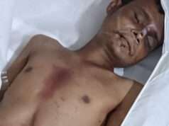 सिर में चोट लगने से युवक की हुई मृत्यु