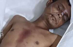 सिर में चोट लगने से युवक की हुई मृत्यु