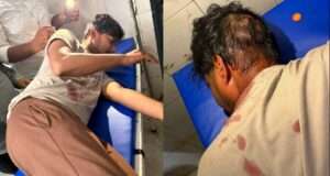 बढ़नी में दुस्साहस: चाय की दुकान पर बैठे युवक पर चाकू से जानलेवा हमला, सिर में गंभीर चोट, मेडिकल कॉलेज रेफर