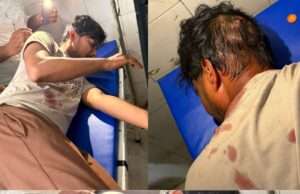 बढ़नी में दुस्साहस: चाय की दुकान पर बैठे युवक पर चाकू से जानलेवा हमला, सिर में गंभीर चोट, मेडिकल कॉलेज रेफर