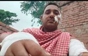 पाठकपुर में आवारा कुत्ते ने सात लोगों को काटा